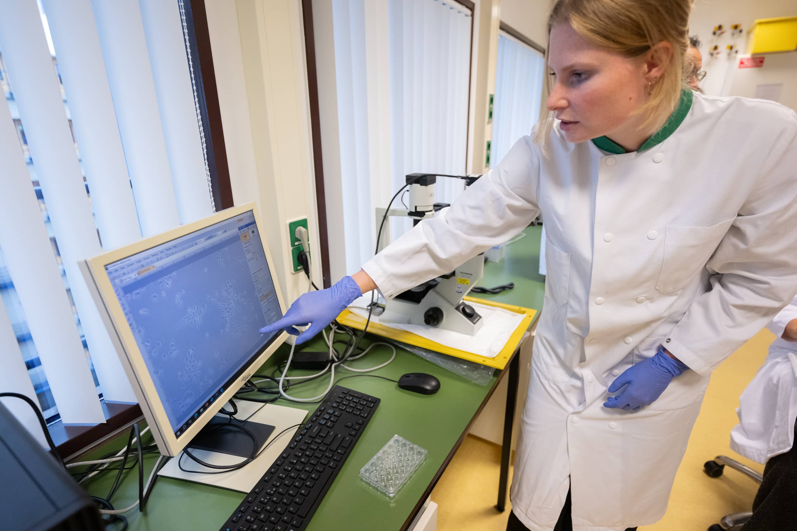 onderzoeker laat microscoopbeeld van huidcellen zien op scherm