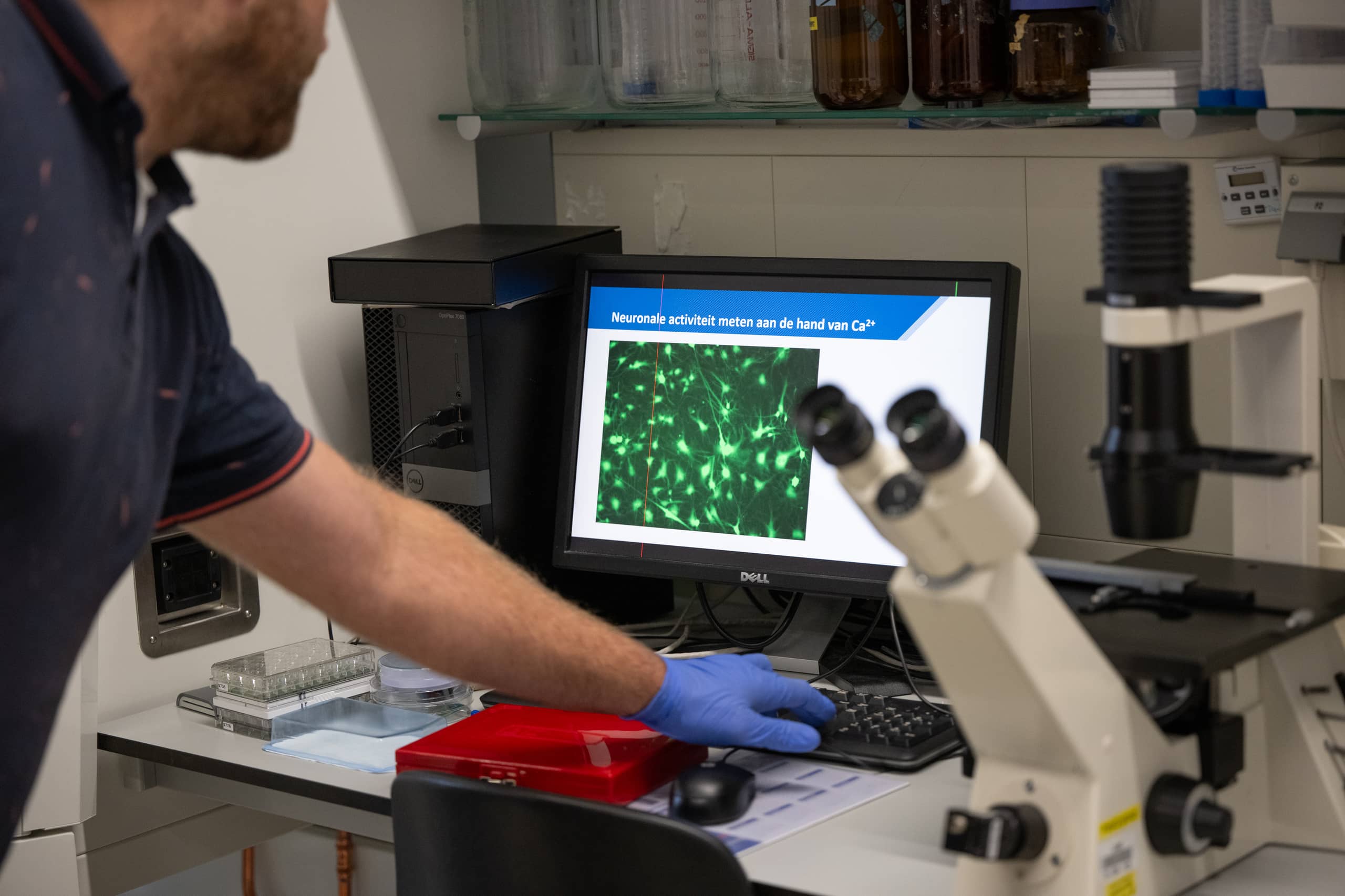 Imaging op beeldscherm van 3D-hersenmodel van humane cellen