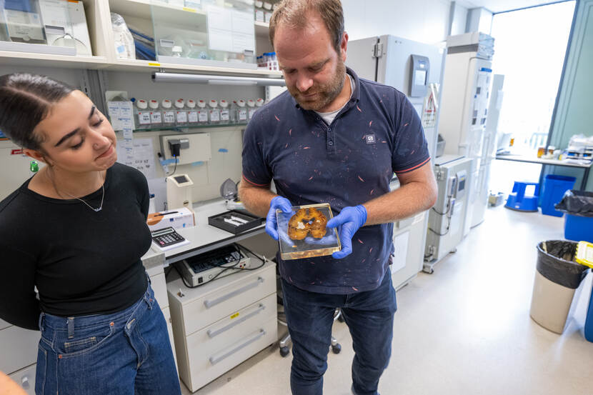 Ronald Buijsen van het LUMC laat preparaat van menselijke hersenen, muizenhersenen en 3D-hersenmodel zien
