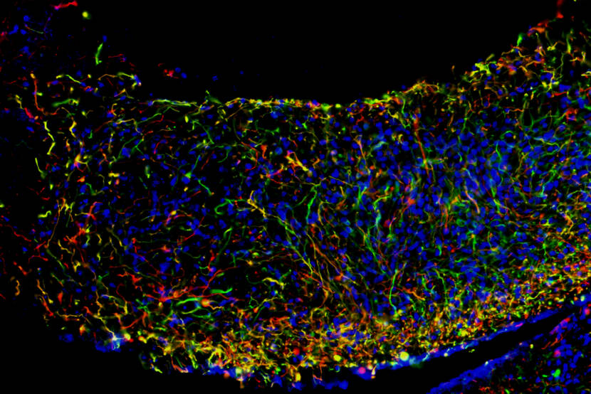 Organoid